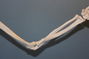 骨密度检查数据怎么看？如何判断骨密度是否正常？