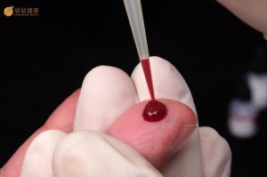 小儿缺铁性贫血适宜吃什么？有哪些饮食禁忌呢？