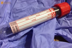 血常规检查，企业体检必做项目