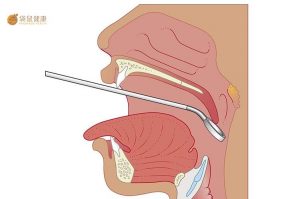 做间接喉镜检查有什么作用，需要注意哪些事项？