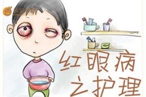 红眼病多发于小孩子身上，具有传染性，要当心！