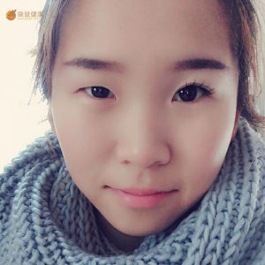 眼睛小小的人适合开眼角